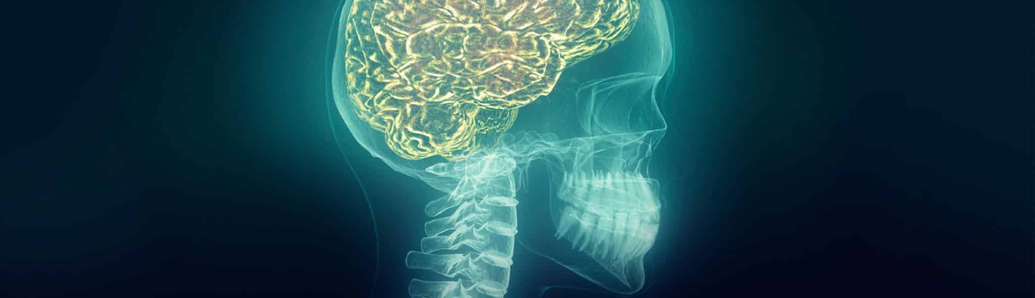 Howie, Sacks & Henry LLP – Personal Injury Law – Brain Injuries