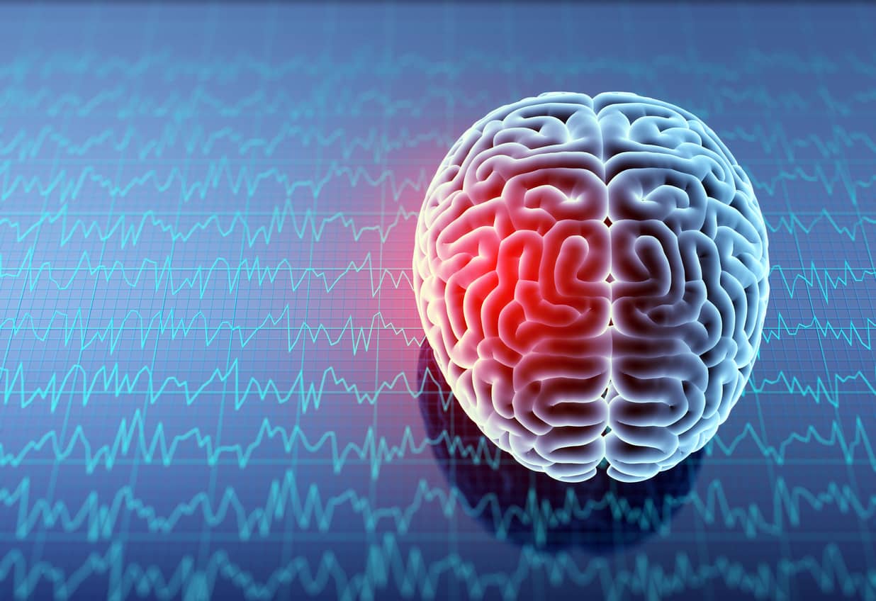 Litigating Mild Traumatic Brain Injury Cases: Use Lay Witnesses to Tell an Emotionally Compelling Story Litigating Mild Traumatic Brain Injury Cases: Use Lay Witnesses to Tell an Emotionally Compelling Story